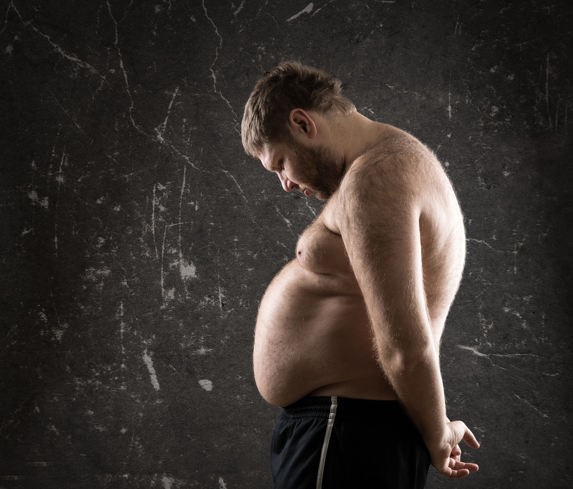 Übergewicht Wieso Manchen Menschen Abnehmen Schwerer Fällt Als Anderen Spektrum Der Wissenschaft