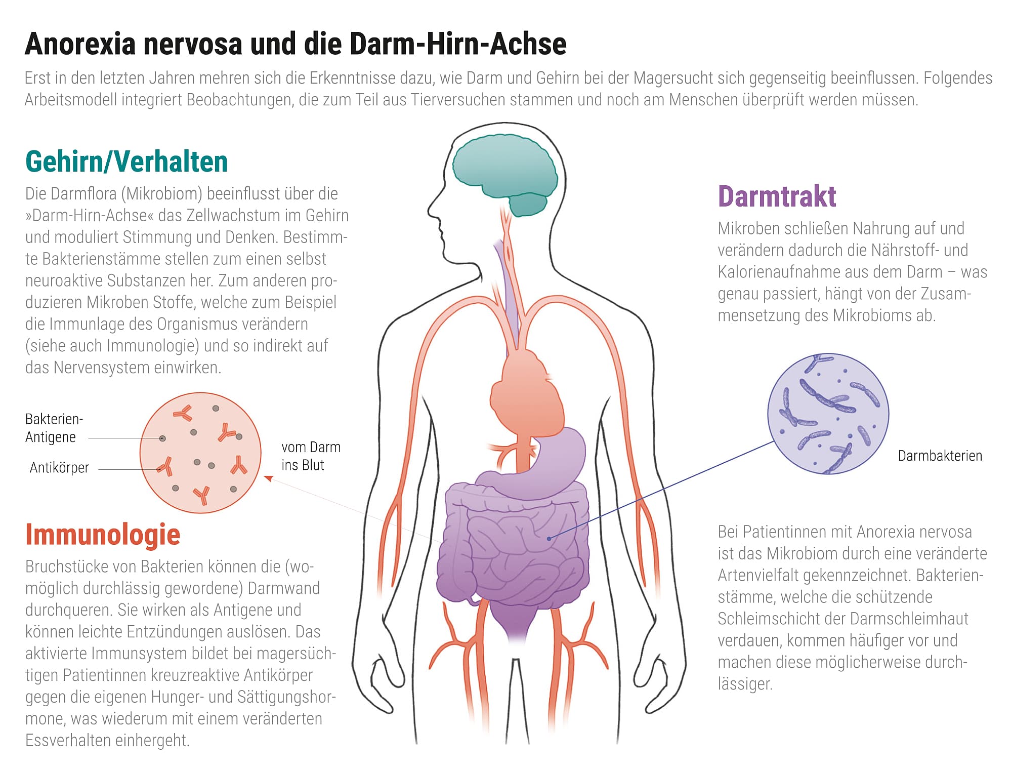 Essstorungen Neue Wege Aus Der Magersucht Spektrum Der Wissenschaft