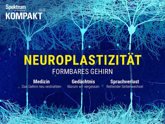 Resumen del espectro: neuroplasticidad - cerebro maleable